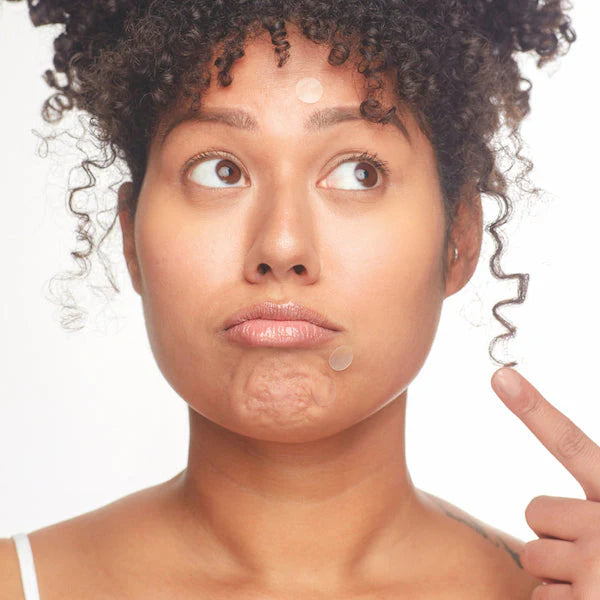 Not A Spot Gunk Absorbing Hydrocolloid Dots